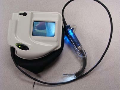 36 Attēli Nr. 21.,22. GlydeScope videolaringoskops un uz LCD monitorā tā attēlotā aina (laringoskopija) (veraton.com).