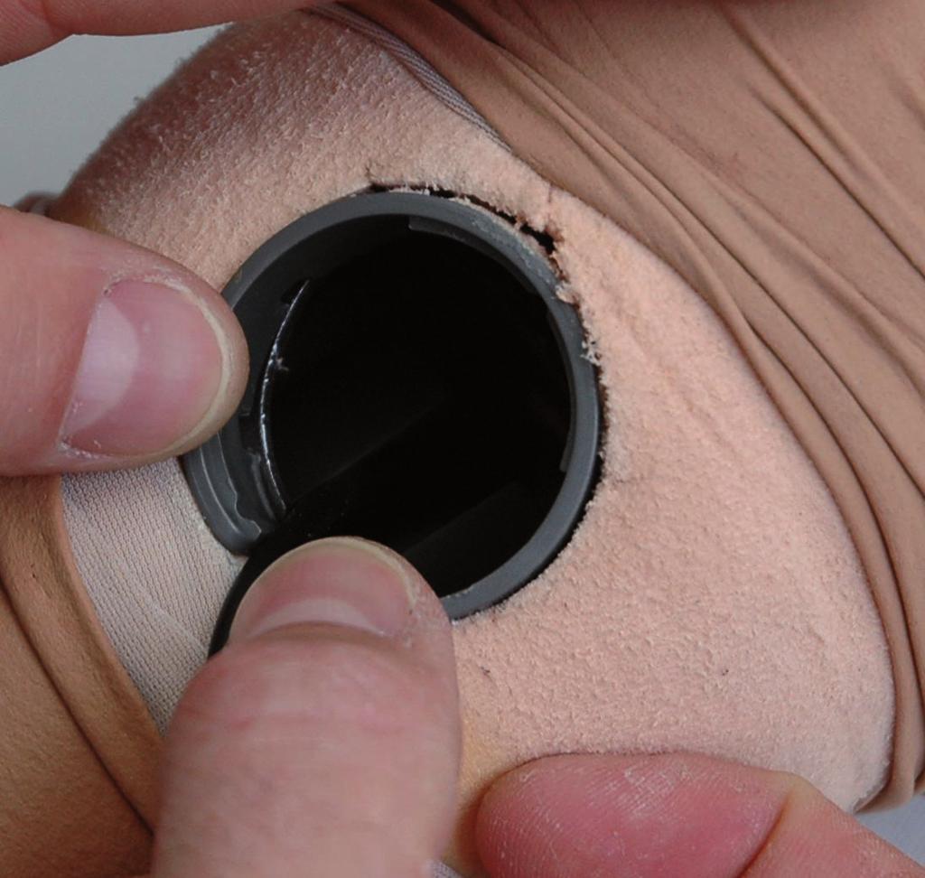 3) Cortar uma abertura circular na cobertura estética de espuma, de forma que o anel de montagem possa ser aplicado na estrutura da articulação de joelho sobre a respectiva abertura.