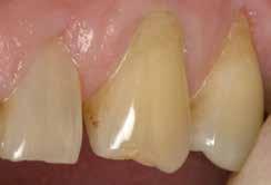 Tam nav līdzvērtīga materiāla, un tas ir ērti izmantojams ikdienas profilaktiskajai zobārstniecībai. Dr.