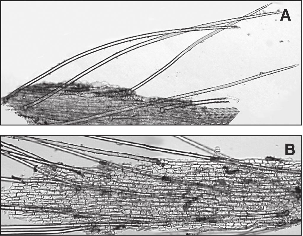 I. Samsone 48 8. attēls. Vienšūnas matiņi uz zemeņu škirņu Korona (A) un Zephyr (B) lapām. Nogrieznis 0.1 mm. 10. tabula.