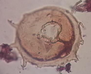 µm) Centropyxis aculeata