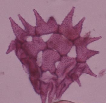 sklerīdas (500 µm)