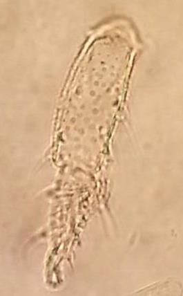 Canthocamptus spermatosporas (4.15.att.