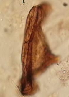 Hyalosphenia elegans (garumā- 70 µm) Canthocamptus