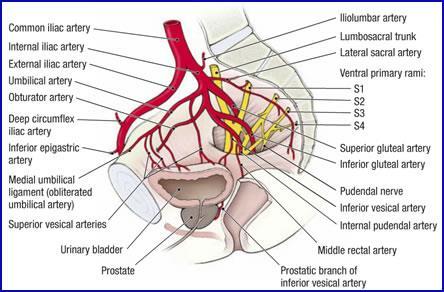 Arteriāls bojājums pie iegurņa lūzumiem Mazā iegurņa/ekstraperitoneāla hemorāģija, vairāk kā 500ml, ar 50% lielāko varbūtību ir arteriāls
