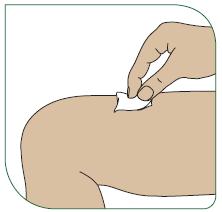 2 - Injekcijas vietā notīriet ādu ar spirtā samitrinātu tamponu; ļaujiet tai nožūt.