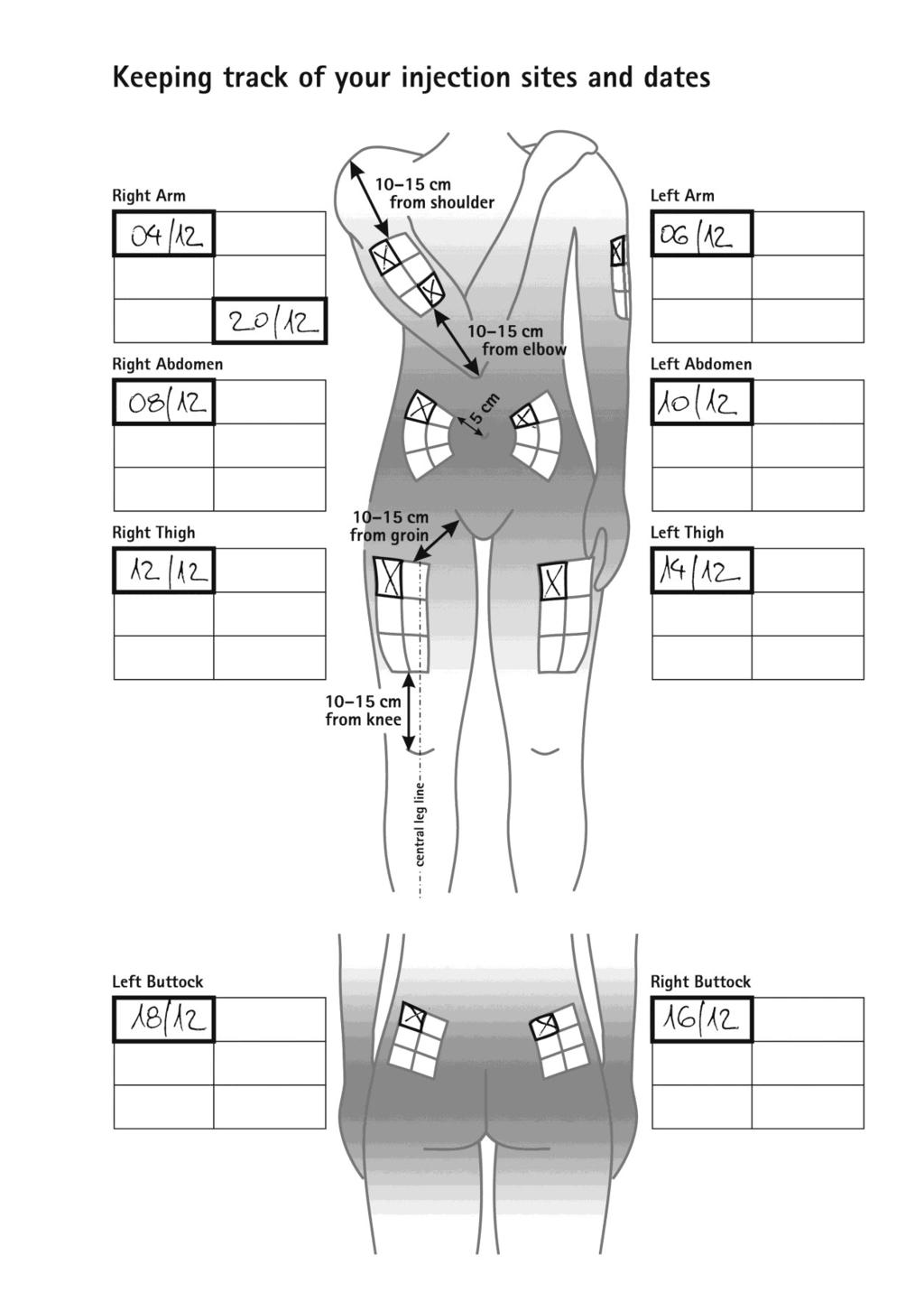 INJEKCIJU PIERAKSTA PIEMĒRS: Injekciju vietu un datumu dokumentēšana Labā roka 10--15 cm no pleca Kreisā roka Vēdera labā puse 10-15 cm no