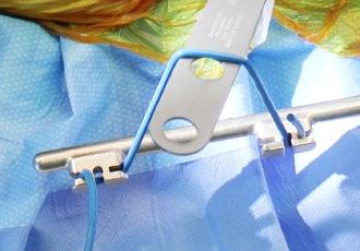 This specialized system allows surgeons to attach retractor blades to a stable table mounted frame which eliminates the need for extra staff to hold retractors and weights.
