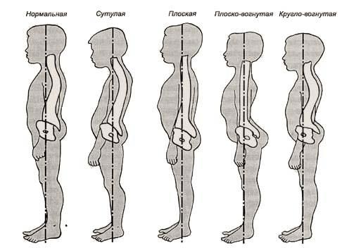 Stājas traucējumu veidi Nepareiza stāja ir raksturīga ar ķermeņa daļu asimetrisku stāvokli un ķermeņa priekšpuses un mugurpuses muskulatūras un saišu savstarpējā līdzsvara un tonusa izmaiņām.