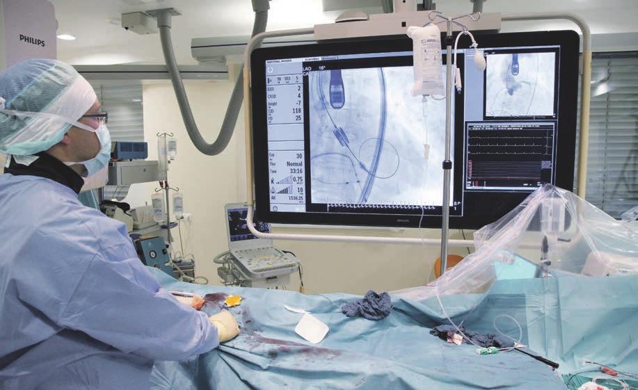 MODERNĀS TEHNOLOĢIJAS 7 palīdēt pacientiem, kurus agrāk neoperēja Hibrīdoperāciju ālē notiek TAVI operācija.