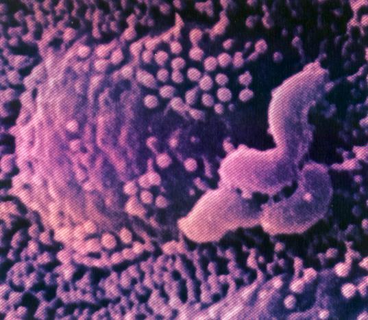 Helicobacter pylori šūnas pie kuņģa gļotādas;