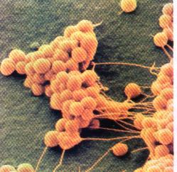 Staphylococcus aureus izraisa strutojošas infekcijas Staphylococcus spp. uz ādas, aug vidē ar 10 % NaCl, izdala enterotoksīnus; pienā, gaļā, konditorejas izstrādājumos.