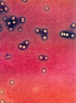 pneimoniju Streptococcus pyogenes