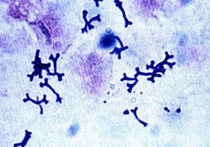 Bifidobacterium anaerobas, mezofilas, sastop zarnu traktā.
