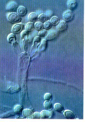 Pārtikā nozīmīgās pelējumsēnes Aspergillus ģints: Aspergillus flavus aflatoksīni; A. ochraceus ohratoksīns A; A. oryzae producē amilāzi (hidrolizē cieti); A.