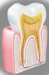 pile neizlīst 9 Ielejiet 5 pilienus atvērtajā pulvera kapsulā 10 B Pielietojums: BIODENTINE var izmantot jebkurā vietā kur ir bojāts dentīns.